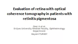 Evaluation  of retina  with