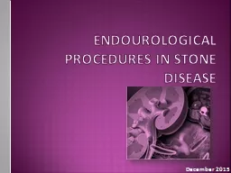 Endourological  procedures in stone disease