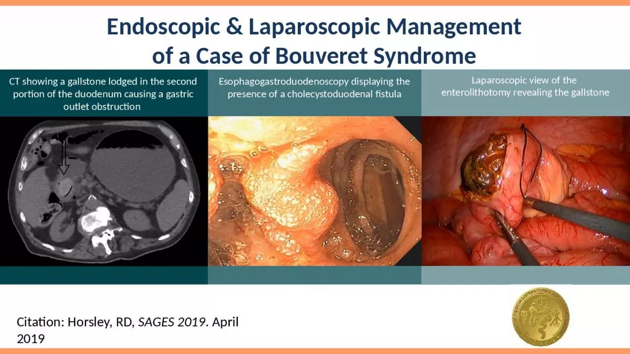 PPT-Endoscopic & Laparoscopic Management