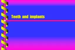 Teeth  and  implants The  tooth  originally  formed with in the  jaws  &  erupted  through  the