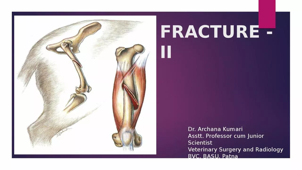 FRACTURE -  II . Dr. Archana