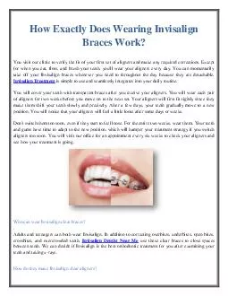 How Exactly Does Wearing Invisalign Braces Work?