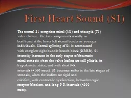 First Heart Sound (S1) The normal S1 comprises mitral (M1) and tricuspid (T1) valve closure.