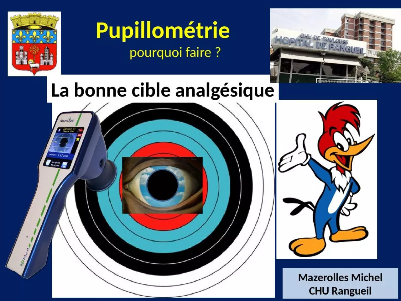 Pupillométrie   pourquoi faire ?