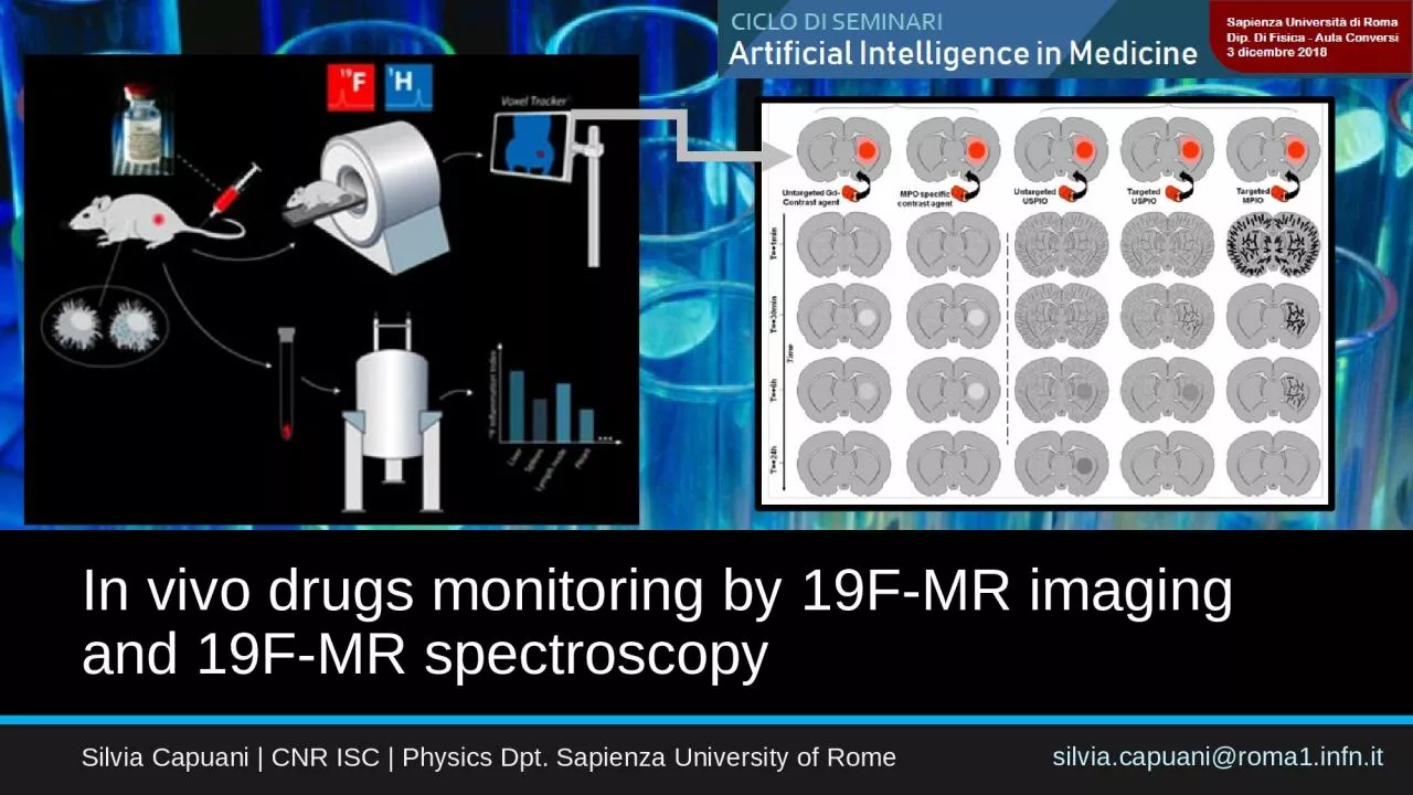 In vivo drugs monitoring by 19F-MR imaging and 19F-MR spectroscopy