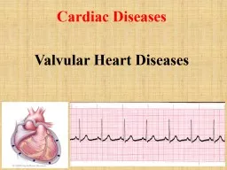 Cardiac Diseases Valvular Heart Diseases