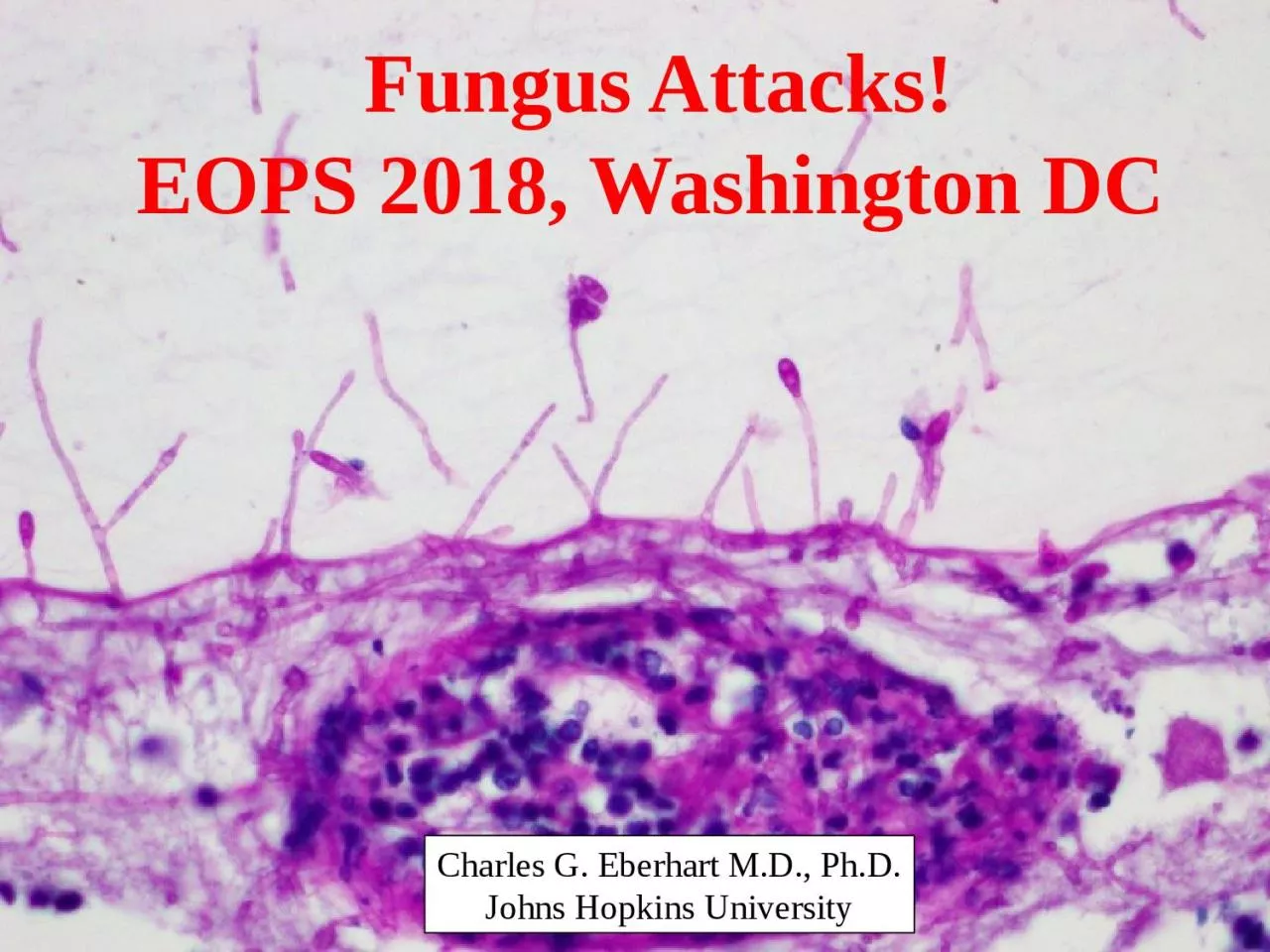 Fungus Attacks! EOPS 2018, Washington DC