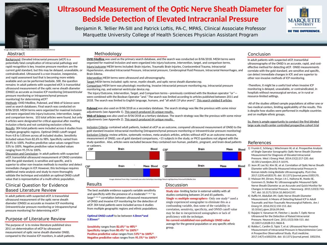Ultrasound Measurement of the Optic Nerve Sheath Diameter for Bedside Detection of Elevated