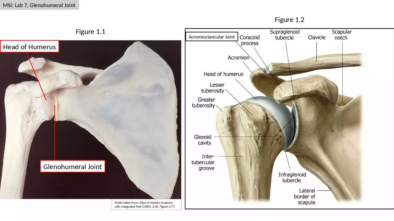 MSI: Lab 7, Glenohumeral Joint