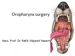Oropharynx  surgery Assis