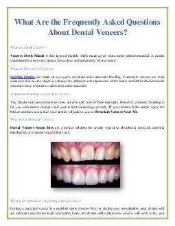 What Are the Frequently Asked Questions About Dental Veneers?
