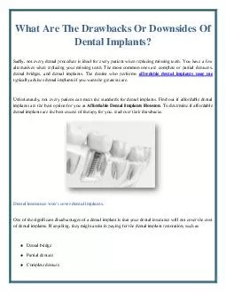 What Are The Drawbacks Or Downsides Of Dental Implants?