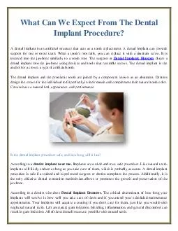 What Can We Expect From The Dental Implant Procedure?