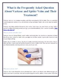 What is the Frequently Asked Question About Varicose and Spider Veins and Their Treatment?