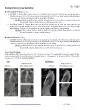 Scoliosis Seriesray GuidelineRoutineInitial Workup2 view AP ERECTPa