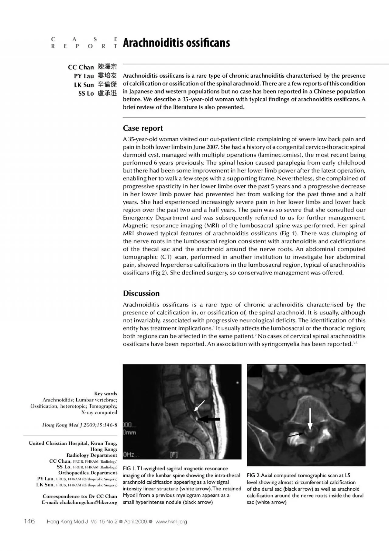 PDF-performed 6 years previously The spinal lesion caused paraplegia from