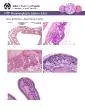 Nose Epithelium