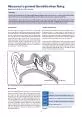 Measures to prevent Barotitis when 31yingSymptoms and e30ects of