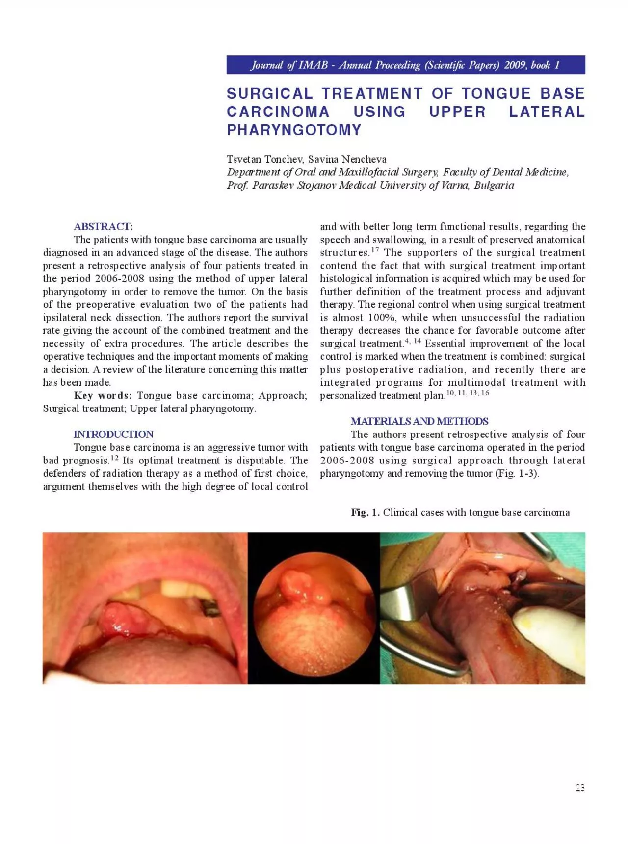SURGICAL TREATMENT OF TONGUE BASECARCINOMA USING UPPER LATERALPHARYNGO