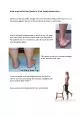 Adult acquired flat foot Posterior Tibial Tendon DysfunctionThere is