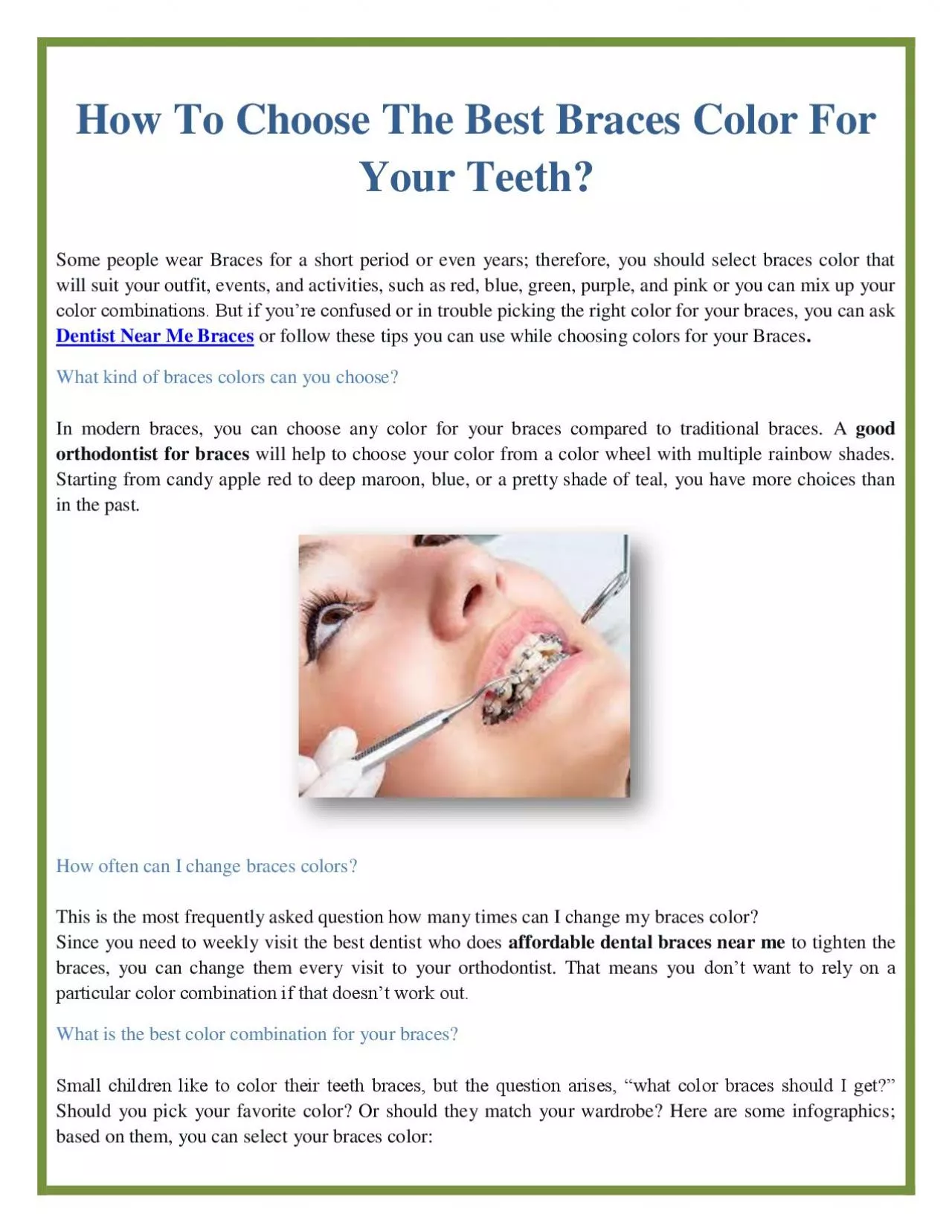 How To Choose The Best Braces Color For Your Teeth?