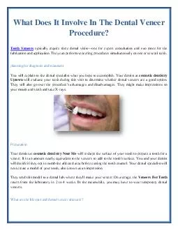 What Does It Involve In The Dental Veneer Procedure?