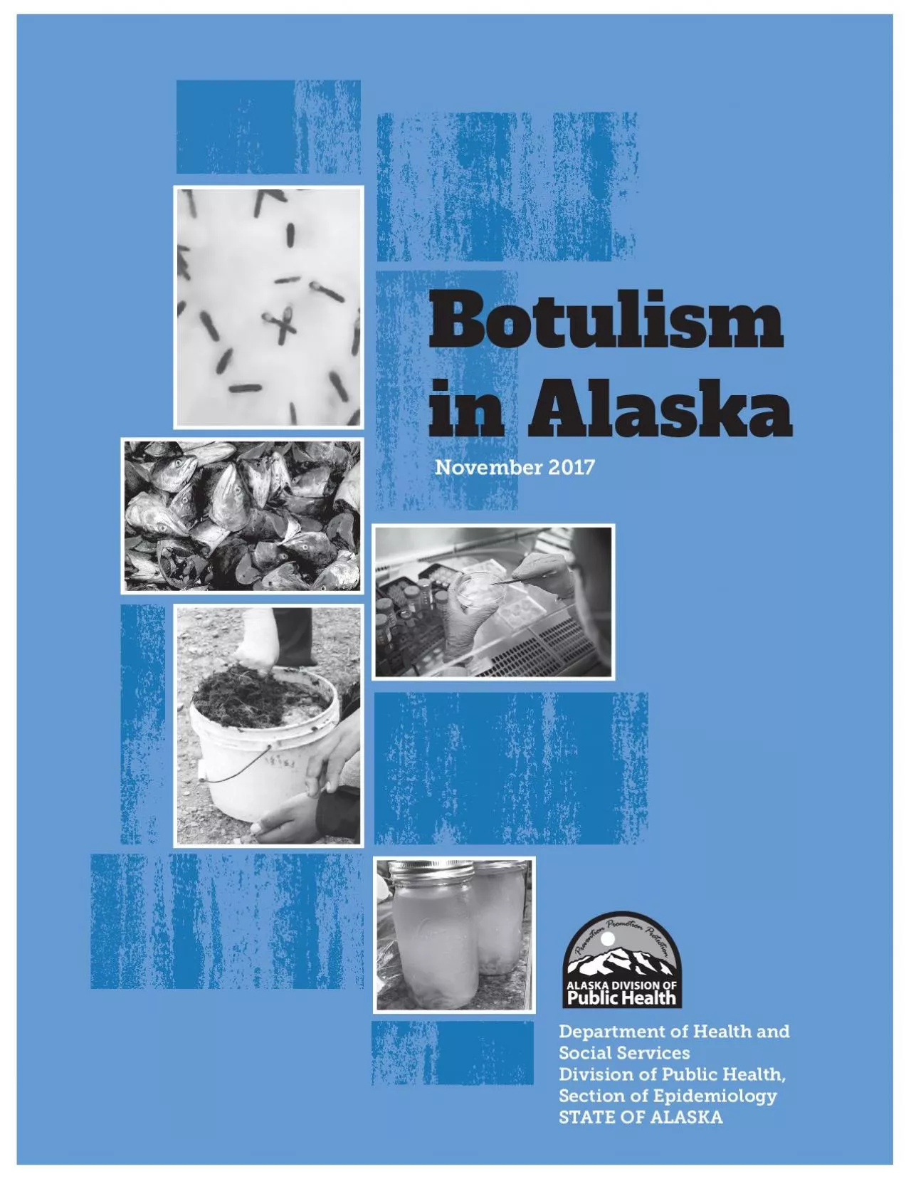 Botulism in Alaska