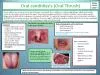 Oral candidiasis Oral Thrush