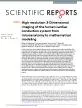 Cardiac arrhythmias and conduction disturbances aect 01 of adults y