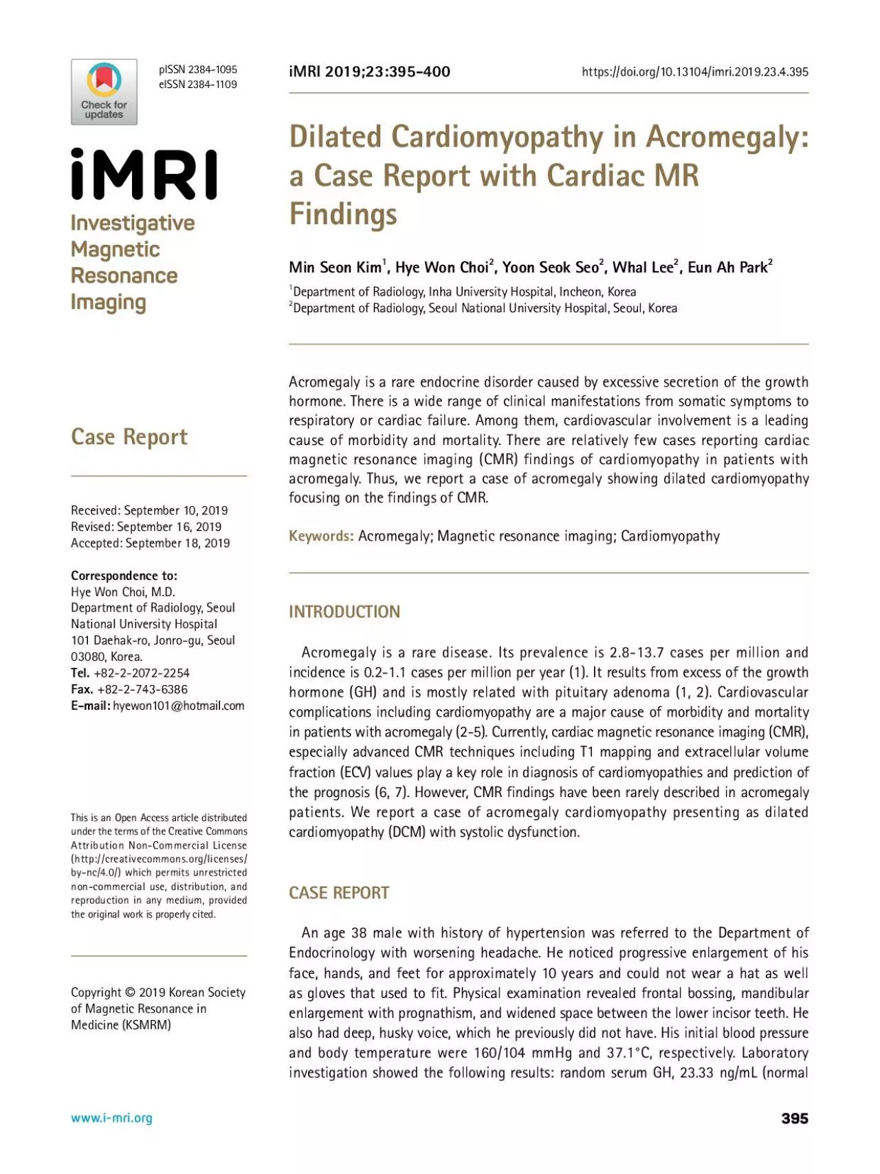 PDF-Dilated Cardiomyopathy in Acromegaly Acromegaly is a rare disease It