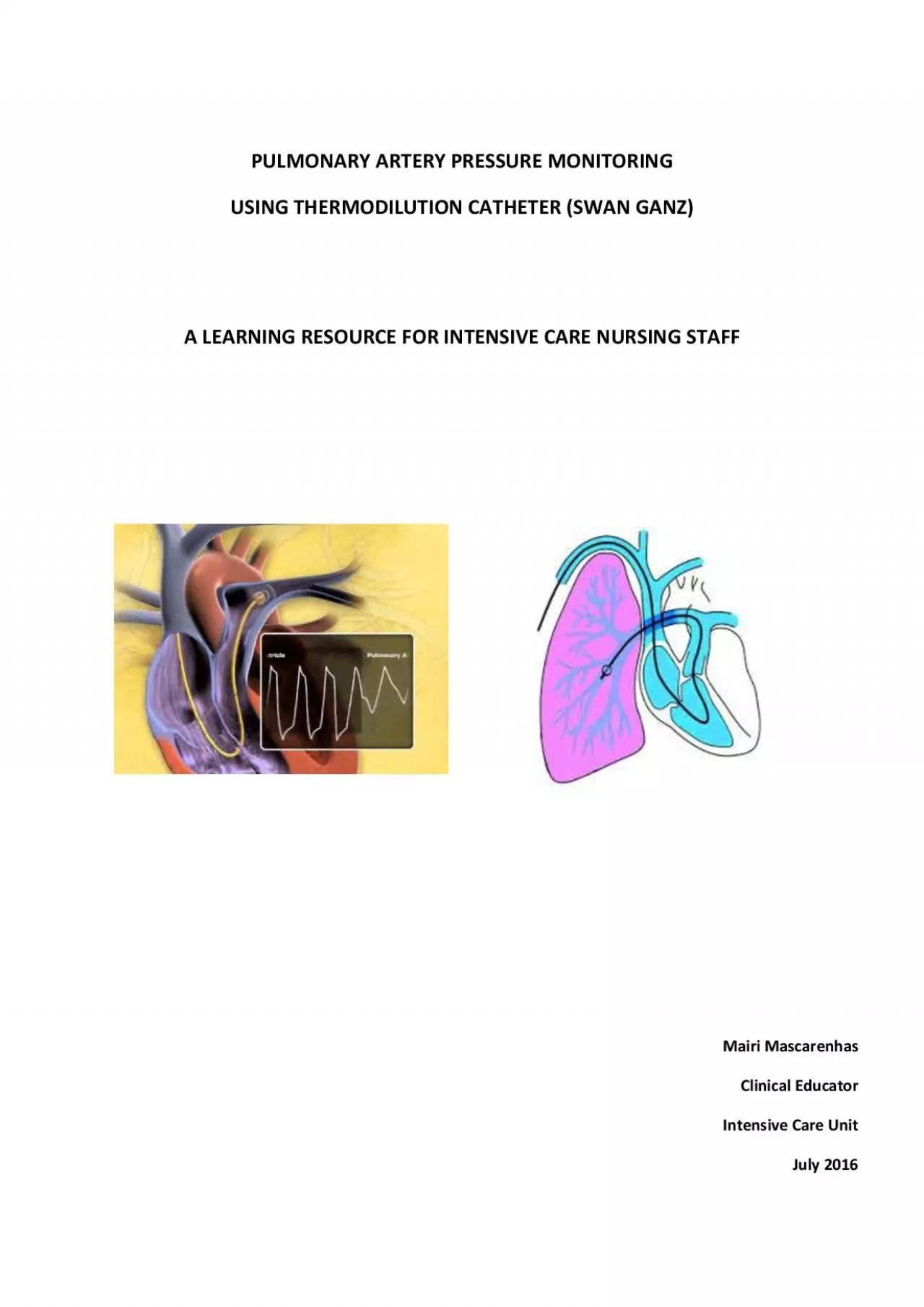 PDF-PULMONARY ARTERY PRESSURE MONITORING