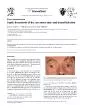 BritishJournalofOralandMaxillofacialSurgery492011e25e26