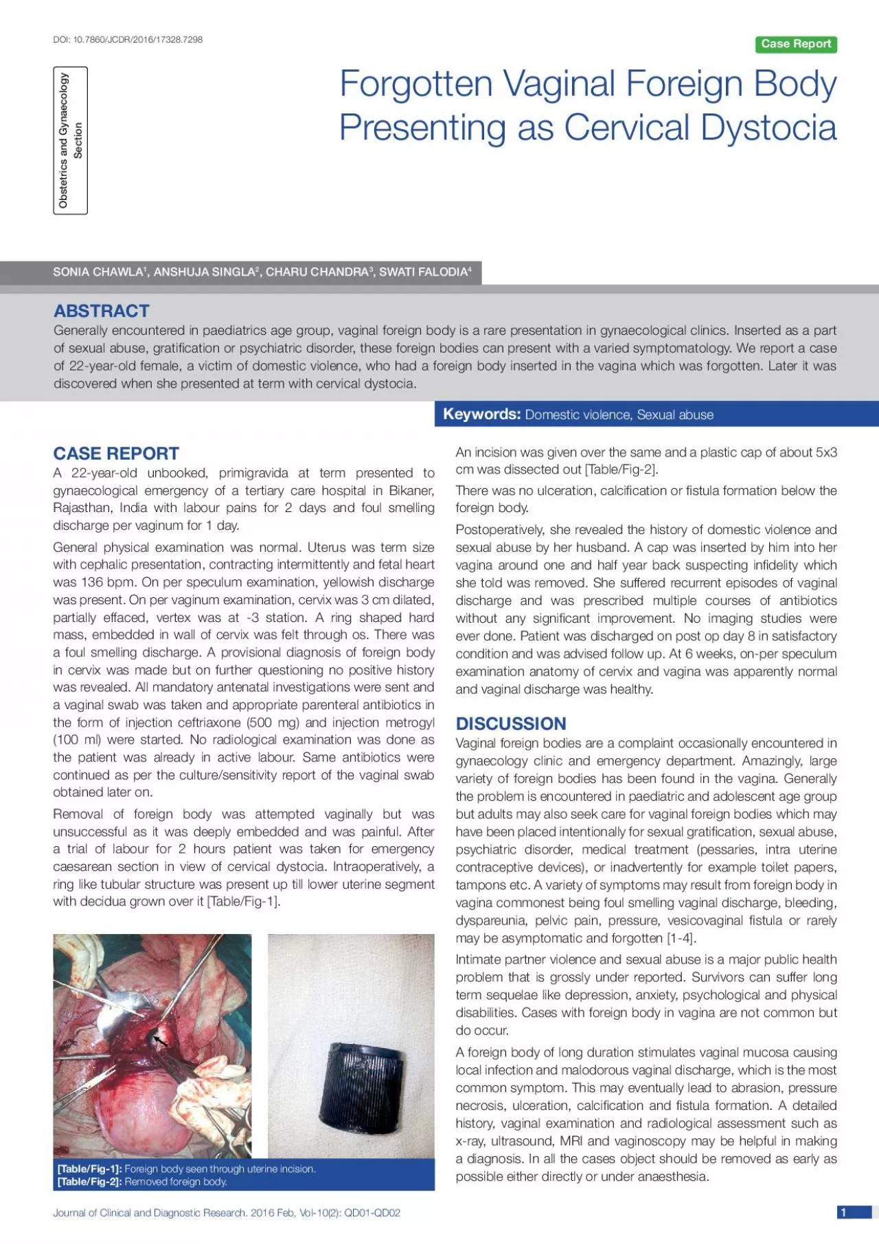 PDF-Journal of Clinical and Diagnostic Research 2016 Feb Vol102 QD01