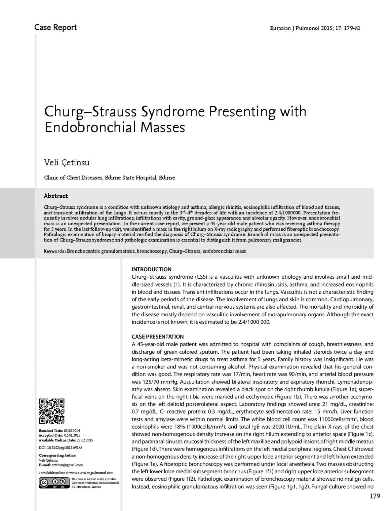 ChurgStrauss syndrome is a condition with unknown etiology and asth