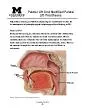 x0000x0000Hospital DentistryPalatal Lift And Modified Palatal Li