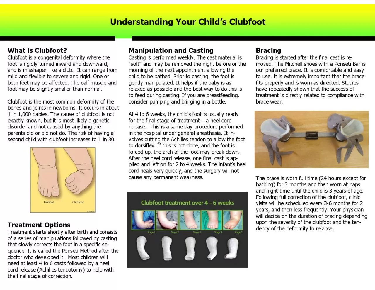 What is Clubfoot