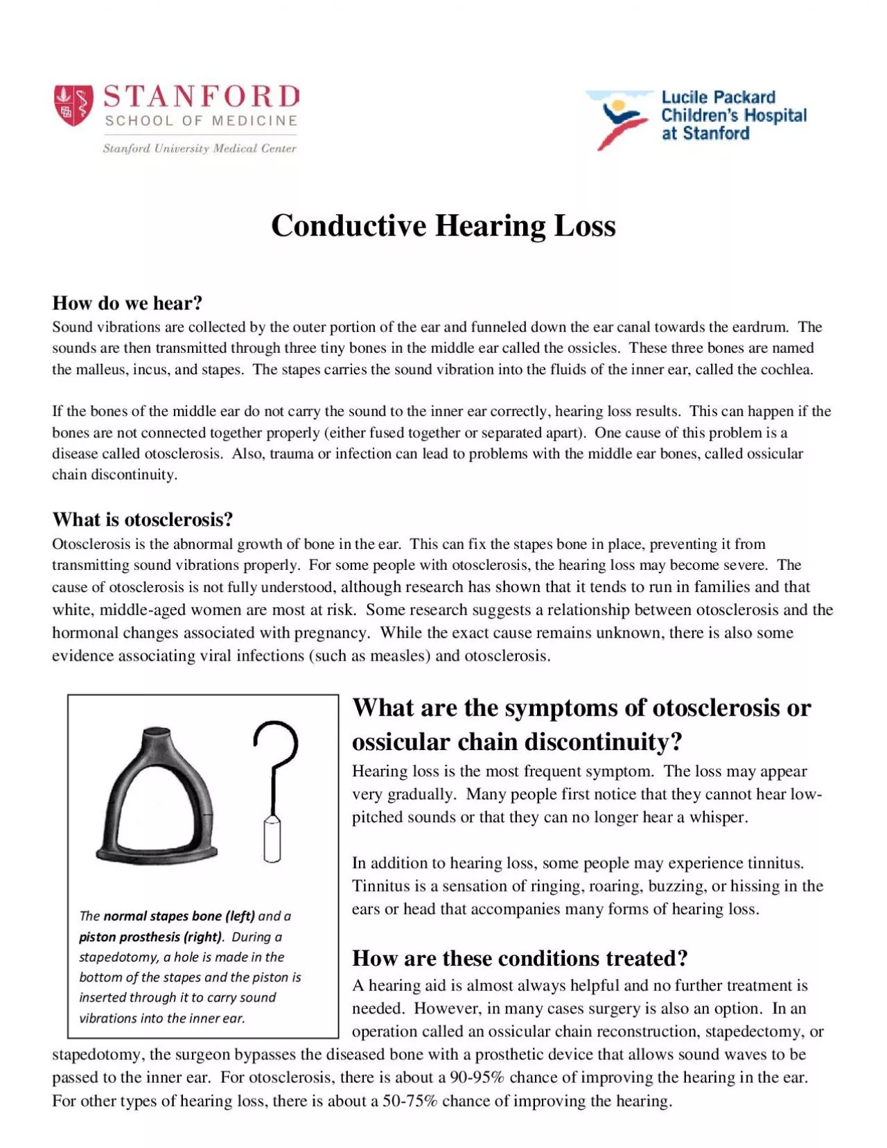 PDF-Conductive Hearing LossHow do we hearSound vibrations are collected b