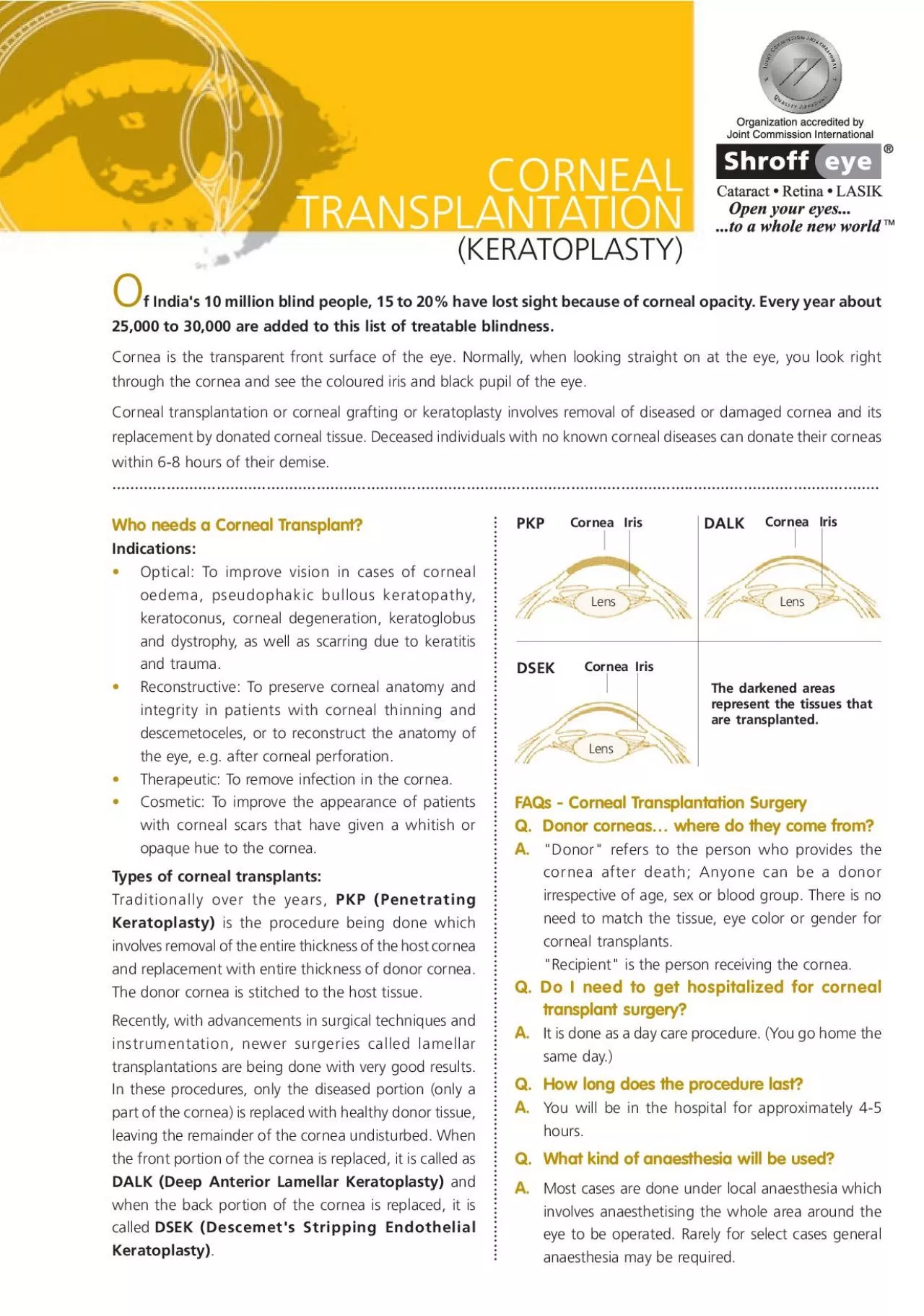 PDF-TRANSPLANTATIONWho needs a Corneal TransplantOptical To improve visi