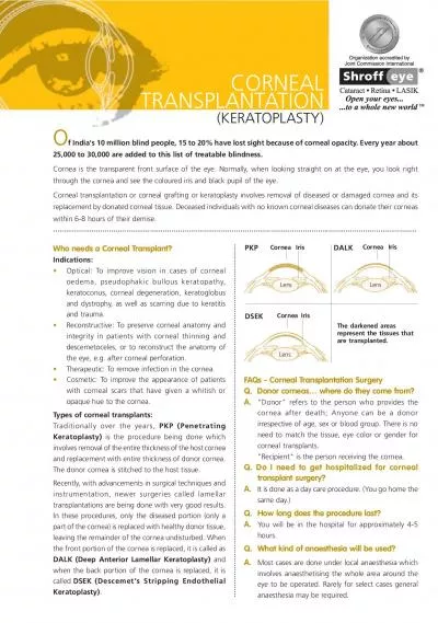 TRANSPLANTATIONWho needs a Corneal TransplantOptical To improve visi