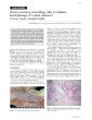 PDF-CASEREPORTHumancoronarymorphologyafterbrachytherapyofinstentrestenosi