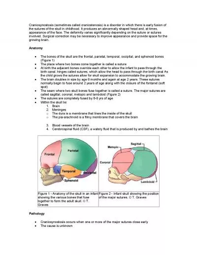 Craniosynostosis sometimes called craniostenosis is a disorder in wh