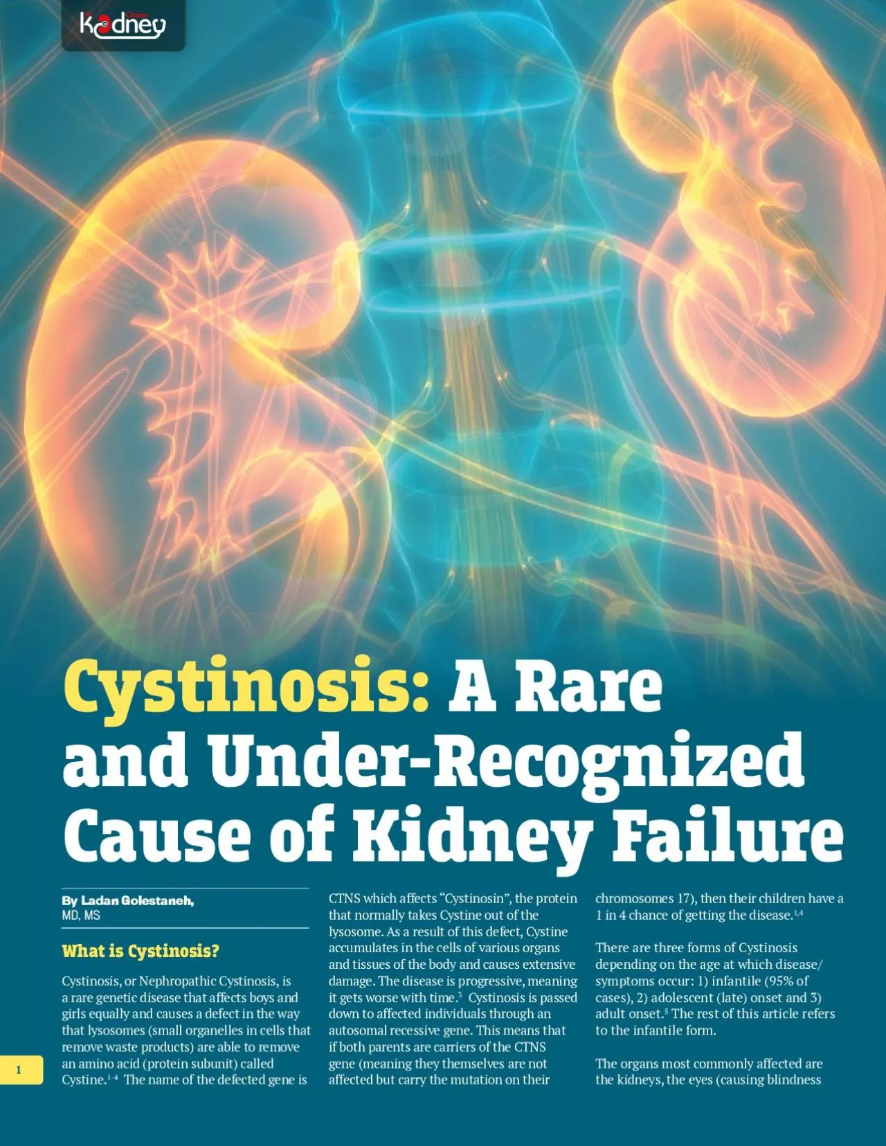 PDF-By Ladan GolestanehMD MSWhat is CystinosisCystinosis or Nephropath