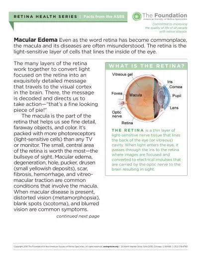 Macular EdemaEven as the word retina has become commonplace the macul