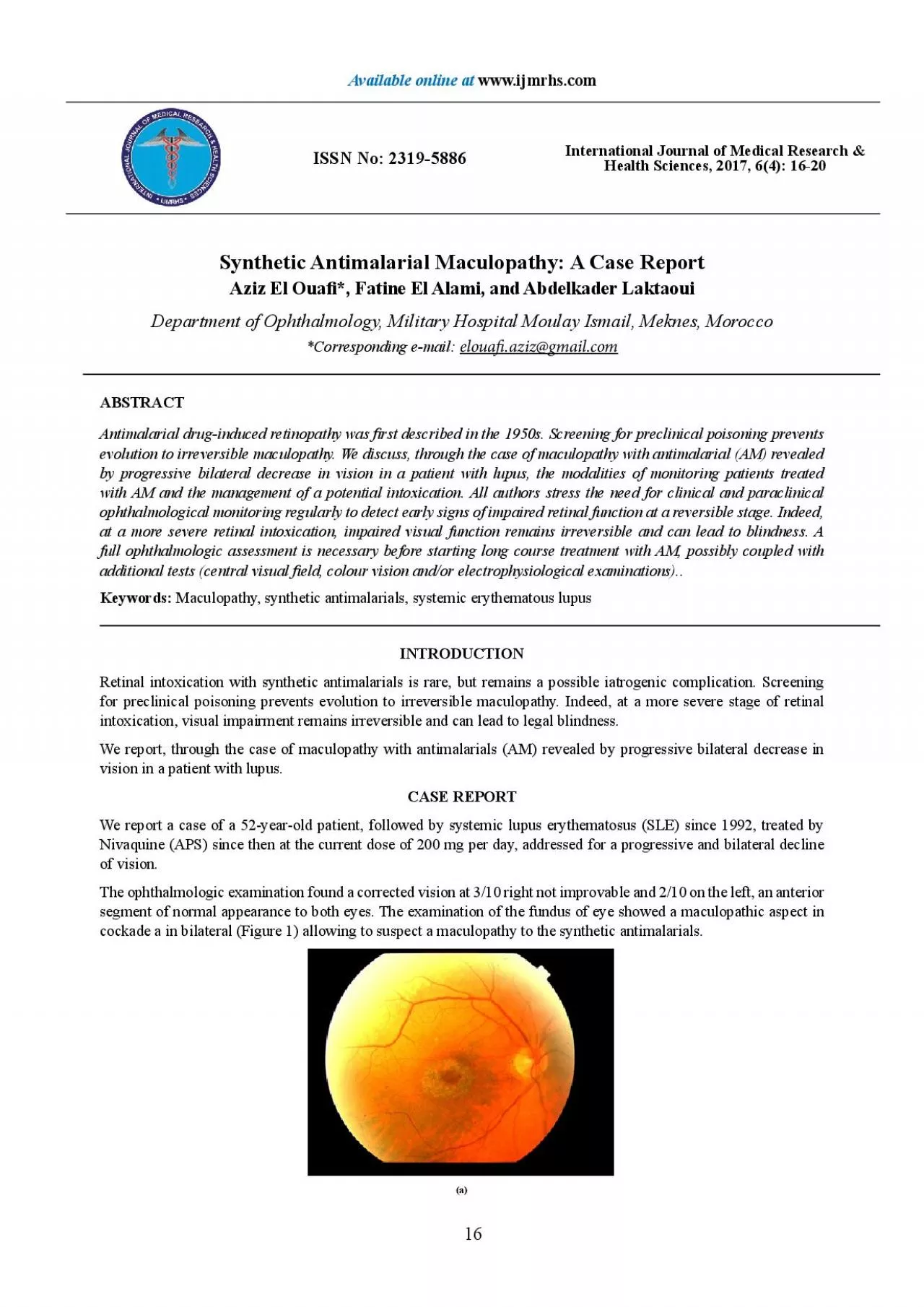 PDF-Synthetic Antimalarial Maculopathy A Case ReportAziz El Ouax0066006