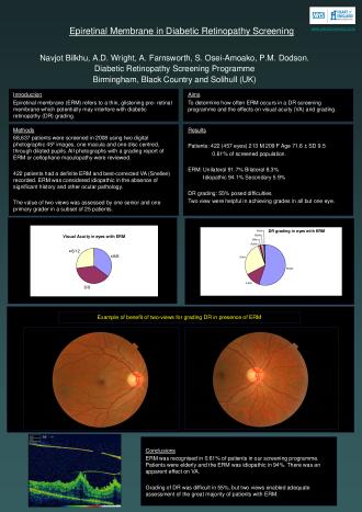 PDF-Epiretinal Membrane in Diabetic Retinopathy Screening