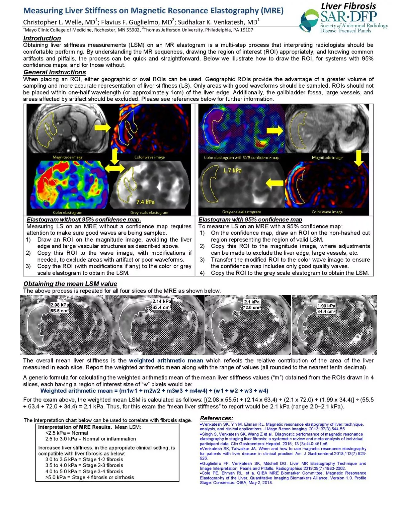 Measuring Liver Stiffness on Magnetic Resonance Elastography MREChri