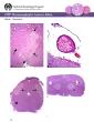 endothelium and the prominent macrophage presence arrows Figure 11