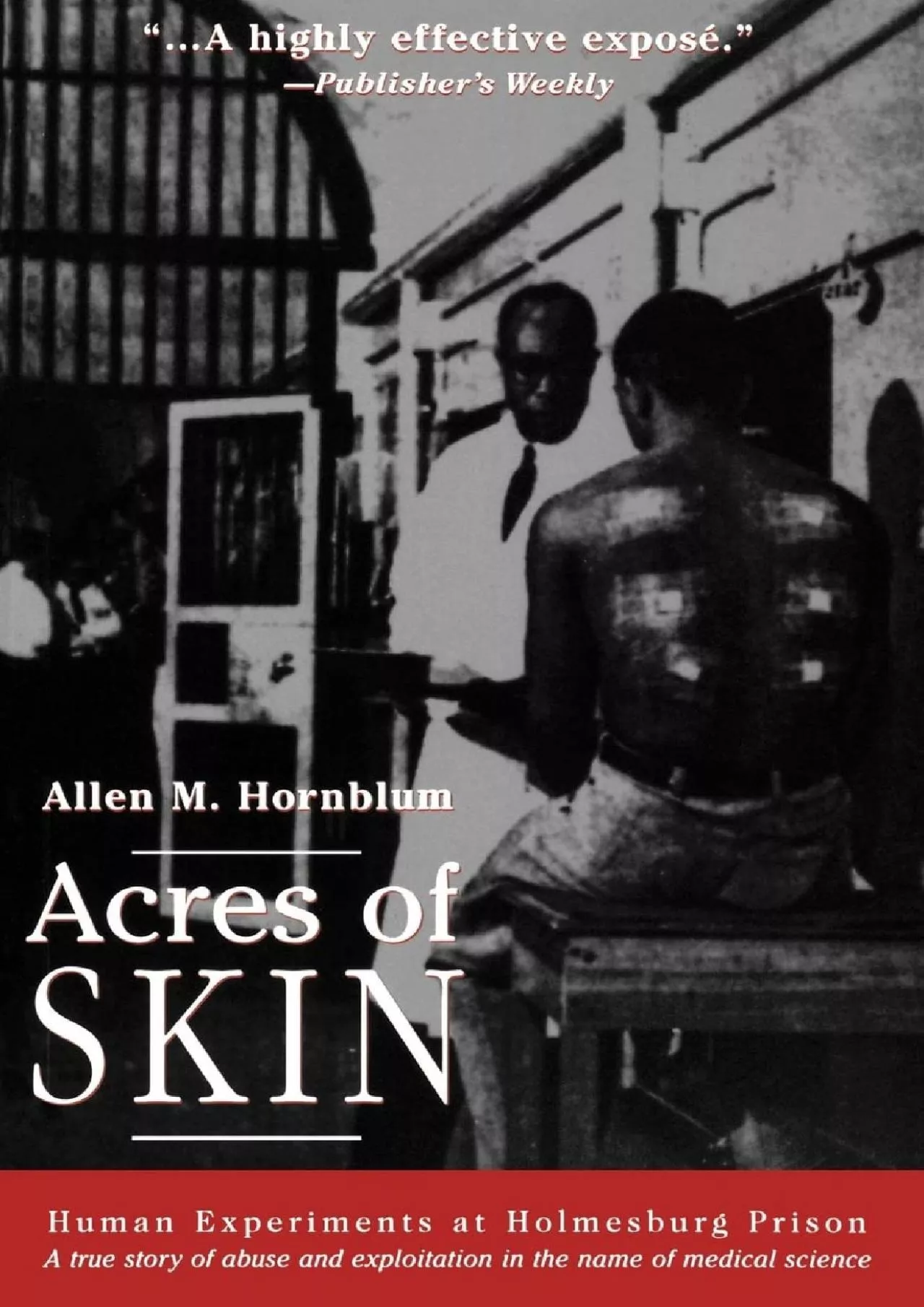 PDF-(READ)-Acres of Skin: Human Experiments at Holmesburg Prison