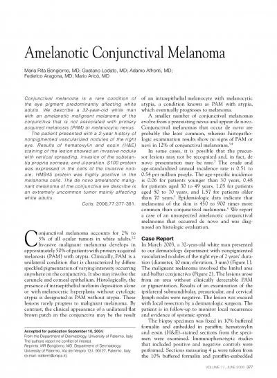 tia propria corneae and ulceration S100 protein