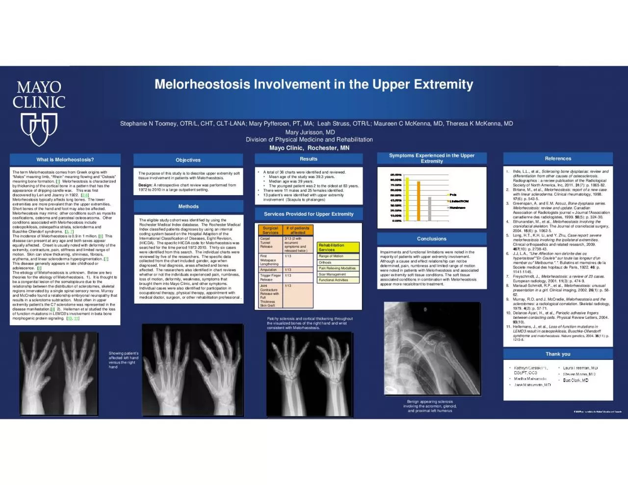 PDF-Melorheostosis Involvement in the Upper Extremity